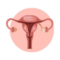 PCOD / PCOS Treatment